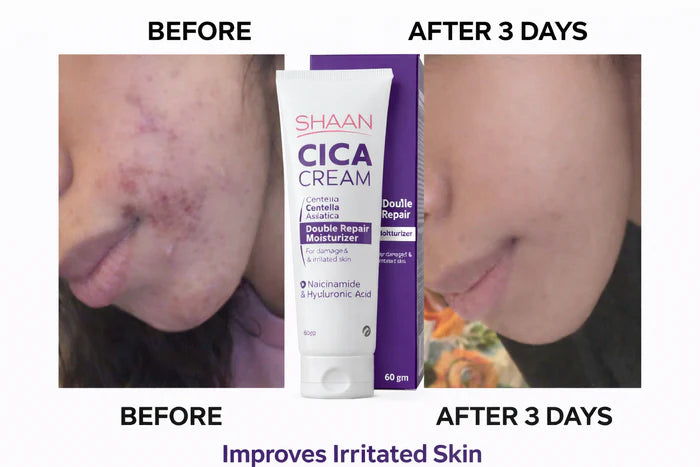 Shaan Cica Cream 60gm - الصورة 2
