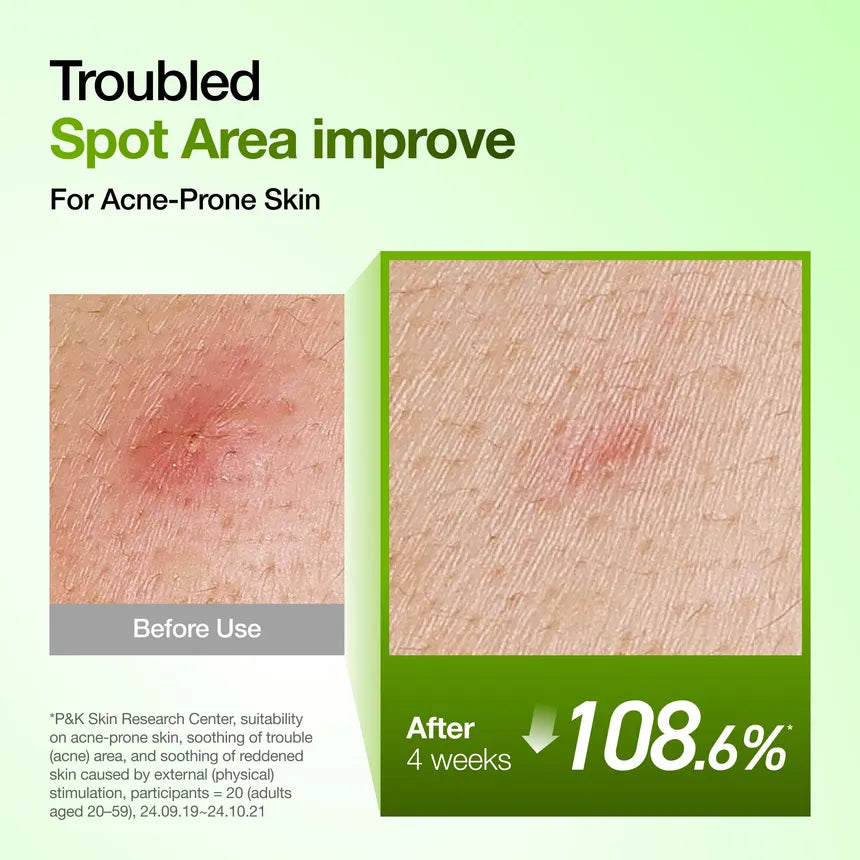 Anua Azelaic Acid 10 Hyaluron Redness Soothing Serum 50ml - الصورة 5
