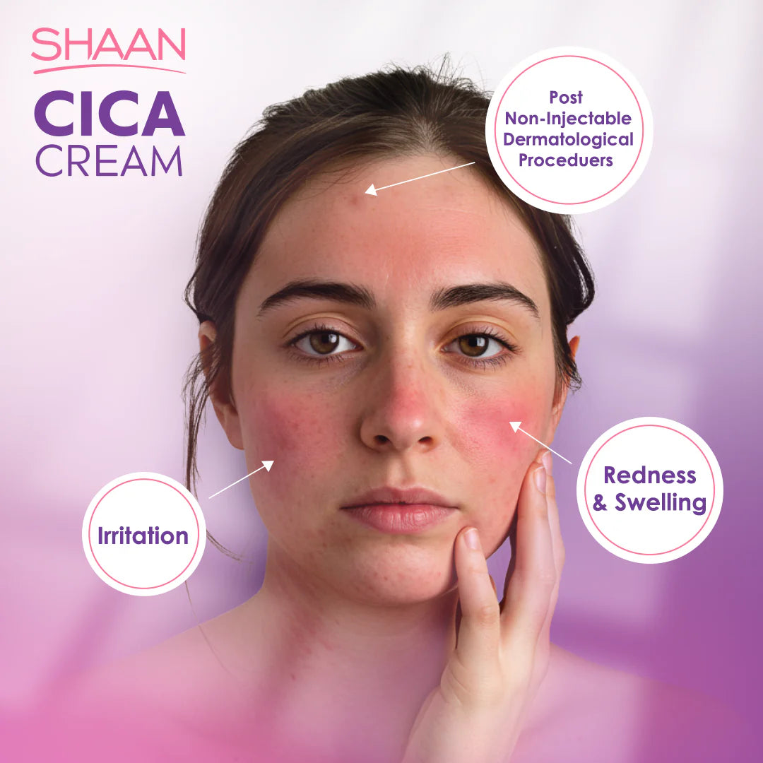Shaan Cica Cream 60gm - الصورة 5